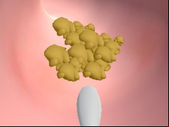 Juego Earwax Clinic